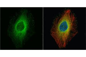 ICC/IF Image ROCK1 antibody [N1N2], N-term detects ROCK1 protein at cytoplasm by immunofluorescent analysis. (ROCK1 anticorps  (N-Term))