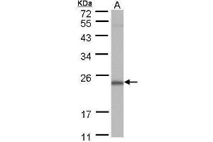 WB Image Sample (30 ug of whole cell lysate) A: A431 12% SDS PAGE antibody diluted at 1:1000 (POLR2G anticorps  (full length))