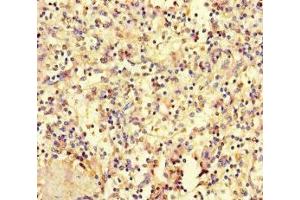 Immunohistochemistry of paraffin-embedded human spleen tissue using ABIN7155778 at dilution of 1:100 (HOXD9 anticorps  (AA 38-276))