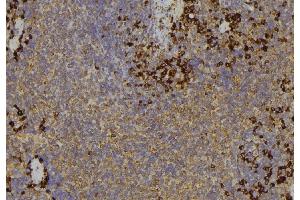 ABIN6279565 at 1/100 staining Human lymph node tissue by IHC-P. (MYO5C anticorps)