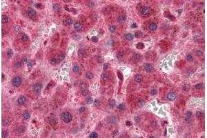 Liver, Human: Formalin-Fixed, Paraffin-Embedded (FFPE) (TIMP2 anticorps)