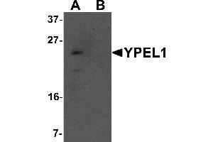 Western blot analysis of YPEL1 in Hela cell lysate with YPEL1 antibody at 1 µg/mL in (A) the absence and (B) the presence of blocking peptide. (YPEL1 anticorps  (N-Term))