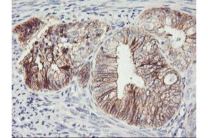 Image no. 4 for anti-Cadherin 2 (CDH2) antibody (ABIN1499626)