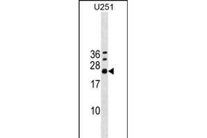 EXOSC4 Antibody (Center) (ABIN1538571 and ABIN2848888) western blot analysis in  cell line lysates (35 μg/lane). (EXOSC4 anticorps  (AA 69-96))