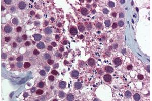 Human Testis: Formalin-Fixed, Paraffin-Embedded (FFPE)