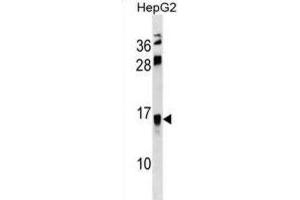 Western Blotting (WB) image for anti-Resistin Like beta (RETNLB) antibody (ABIN3000751) (RETNLB anticorps)