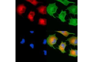 ABIN7094989 and ABIN7099045 staining  cells by IF/ICC.