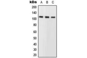 Western blot analysis of PLA2G4A expression in A549 (A), HeLa (B), mouse kidney (C) whole cell lysates. (PLA2G4A anticorps  (N-Term))