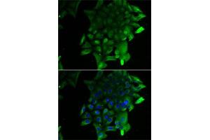 Immunofluorescence analysis of U2OS cells using SEPSECS antibody (ABIN6131515, ABIN6147545, ABIN6147546 and ABIN6222910). (SEPSECS anticorps  (AA 222-501))