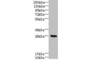 Western blot All lanes: YIPF5 antibody at 5 μg/mL + Mouse liver tissue Secondary Goat polyclonal to rabbit IgG at 1/10000 dilution Predicted band size: 28, 22, 30 kDa Observed band size: 28 kDa (YIPF5 anticorps  (AA 1-124))