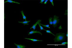 Immunofluorescence of monoclonal antibody to PHB on HeLa cell. (Prohibitin anticorps  (AA 1-272))