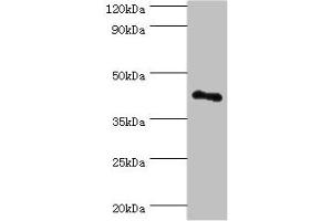 Western blot All lanes: RSAD2 antibody at 8 μg/mL + Jurkat whole cell lysate Secondary Goat polyclonal to rabbit IgG at 1/10000 dilution Predicted band size: 42 kDa Observed band size: 42 kDa (RSAD2 anticorps  (AA 42-361))