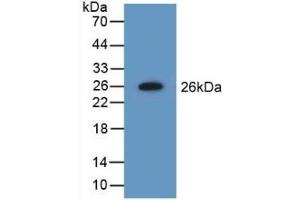 Detection of Recombinant NME5, Mouse using Polyclonal Antibody to Non Metastatic Cells 5, Protein NM23A Expressed In (NME5) (NME5 anticorps  (AA 16-210))