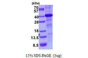 Figure annotation denotes ug of protein loaded and % gel used. (HFE Protéine)
