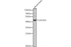 Western blot analysis of extracts of Mouse brain using CACNG4 Polyclonal Antibody at dilution of 1:1000.