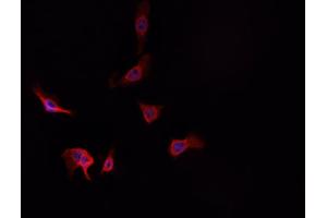 ABIN6269225 staining A-431 cells by IF/ICC. (alpha Adducin anticorps)