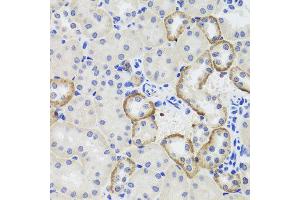 Immunohistochemistry of paraffin-embedded mouse kidney using MTERFD3 antibody at dilution of 1:100 (x40 lens). (MTERFD3 anticorps)
