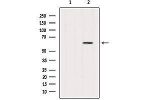 Western blot analysis of extracts from HepG2, using P62/SQSTM1 Antibody.