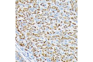 Immunohistochemistry of paraffin-embedded rat ovary using p70 S6 Kinase 2 Rabbit mAb (ABIN7270034) at dilution of 1:100 (40x lens).