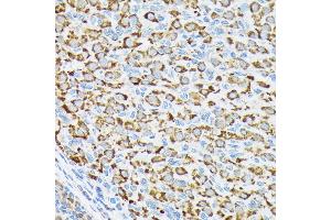 Immunohistochemistry of paraffin-embedded rat ovary using p70 S6 Kinase 2 Rabbit mAb (ABIN7270034) at dilution of 1:100 (40x lens). (RPS6KB2 anticorps)