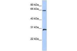 WB Suggested Anti-HOXA5 Antibody Titration: 1 ug/ml Positive Control: Placenta (HOXA5 anticorps  (C-Term))
