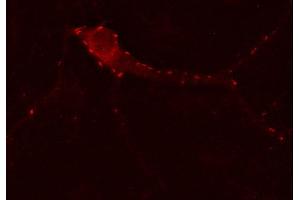 Indirect immunostaining of PFA fixed hippocampus neurons (dilution 1 : 500). (GABRG2 anticorps)
