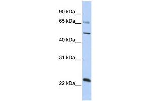 WB Suggested Anti-ZNF597 Antibody Titration:  0. (ZNF597 anticorps  (Middle Region))
