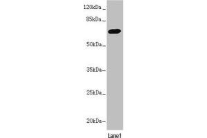 Western blot All lanes: PPP2R3B antibody at 2.