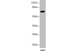 Western blot All lanes: PPP2R3B antibody at 2. (PPP2R3B anticorps  (Regulatory Subunit B))