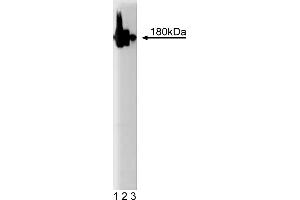 Western Blotting (WB) image for anti-Synaptosomal-Associated Protein 91 (SNAP91) (AA 706-896) antibody (ABIN967993) (SNAP91 anticorps  (AA 706-896))