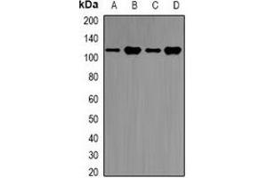 Western blot analysis of E6AP expression in SKOV3 (A), Jurkat (B), mouse brain (C), rat brain (D) whole cell lysates. (ube3a anticorps)