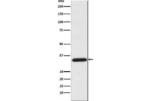 Western blot analysis of UNG expression in HeLa cell lysate.
