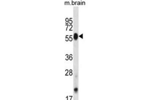Western Blotting (WB) image for anti-CDC-Like Kinase 4 (CLK4) antibody (ABIN2998111) (CLK4 anticorps)