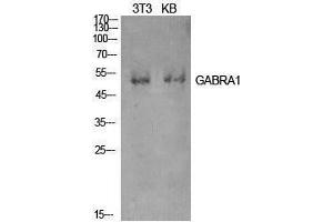 Western Blotting (WB) image for anti-gamma-aminobutyric Acid (GABA) A Receptor, alpha 1 (GABRA1) (Internal Region) antibody (ABIN3181422) (GABRA1 anticorps  (Internal Region))