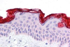 Human Skin: Formalin-Fixed, Paraffin-Embedded (FFPE)