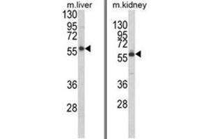 (LEFT) Western blot analysis of PRODH Antibody (RB21343) in mouse liver tissue lysates (35ug/lane). (PRODH anticorps  (Middle Region))