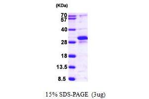 SDS-PAGE (SDS) image for RAS-Like, Estrogen-Regulated, Growth Inhibitor (RERG) (AA 1-199) protein (His tag) (ABIN667876) (RERG Protein (AA 1-199) (His tag))