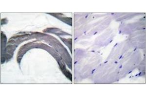 Immunohistochemistry analysis of paraffin-embedded human skeletal muscle, using Glycogen Synthase (Phospho-Ser645) Antibody.