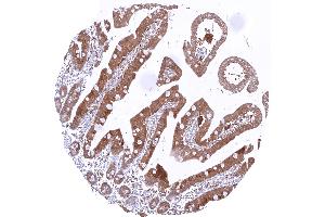 Duodenum with strong cytoplasmic caspase 3 positivity of epithelial cells (Recombinant Caspase 3 anticorps  (Center))