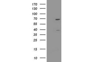Image no. 1 for anti-tRNA Methyltransferase 2 Homolog A (TRMT2A) antibody (ABIN1501522) (TRMT2A anticorps)