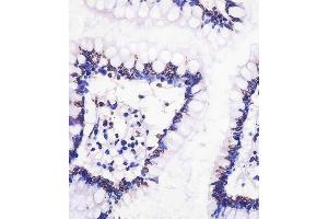 A staining Neurogenin3 in human small intestine tissue sections by Immunohistochemistry (IHC-P - paraformaldehyde-fixed, paraffin-embedded sections).