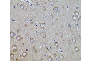 Immunohistochemistry of paraffin-embedded Rat brain using ITGB8 Polyclonal Antibody at dilution of 1:100 (40x lens). (ITGB8 anticorps)