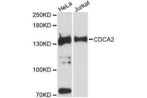 Western blot analysis of extracts of various cell lines, using CDCA2 antibody (ABIN5996800) at 1:3000 dilution. (CDCA2 anticorps)
