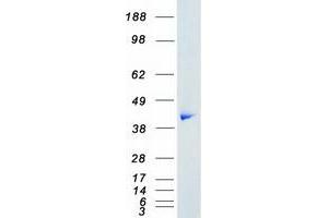 Validation with Western Blot