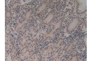 IHC-P analysis of Human Stomach Tissue, with DAB staining. (CIRBP anticorps  (AA 1-172))