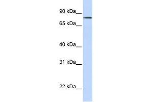 WB Suggested Anti-LST-3TM12 Antibody Titration:  0. (LST-3TM12 anticorps  (Middle Region))