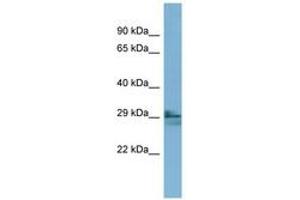 Image no. 1 for anti-Lens Intrinsic Membrane Protein 2, 19kDa (LIM2) (AA 35-84) antibody (ABIN6741876) (LIM2 anticorps  (AA 35-84))