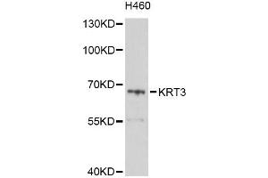 Western blot analysis of extracts of H460 cells, using KRT3 Antibody (ABIN6003816) at 1/1000 dilution. (Keratin 3 anticorps)
