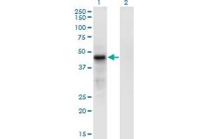 Western Blot analysis of CDC42EP4 expression in transfected 293T cell line by CDC42EP4 monoclonal antibody (M05), clone 3G10.