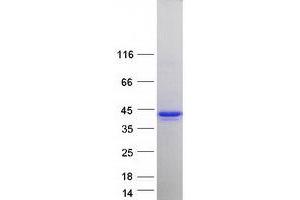 Validation with Western Blot